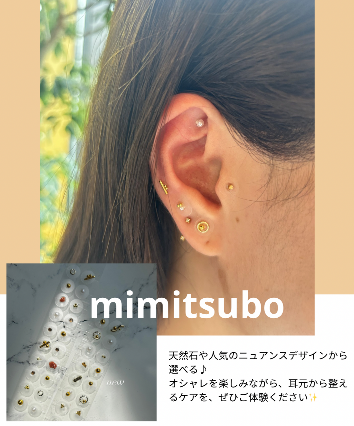 MV